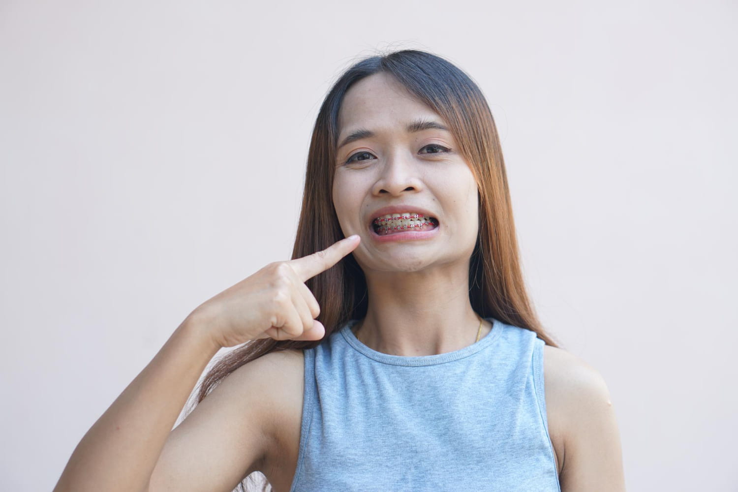 A woman in a sleeveless top proudly points to her braces, showcasing the transformative power of adult orthodontics, all while smiling against a plain background in Greenville, SC