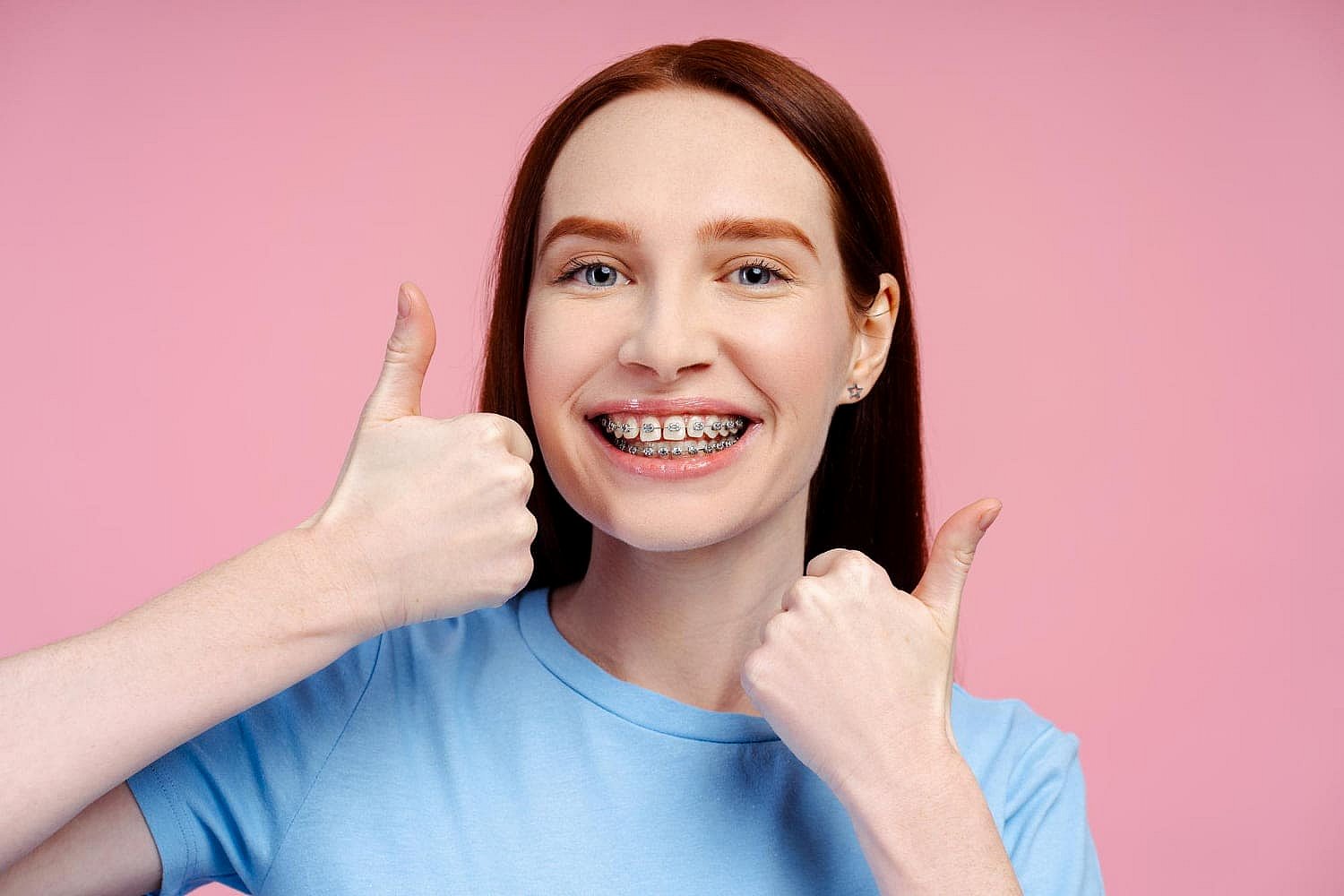 Person with metal braces wearing a blue shirt gives two thumbs up against a pink background, smiling broadly in Greenville, SC