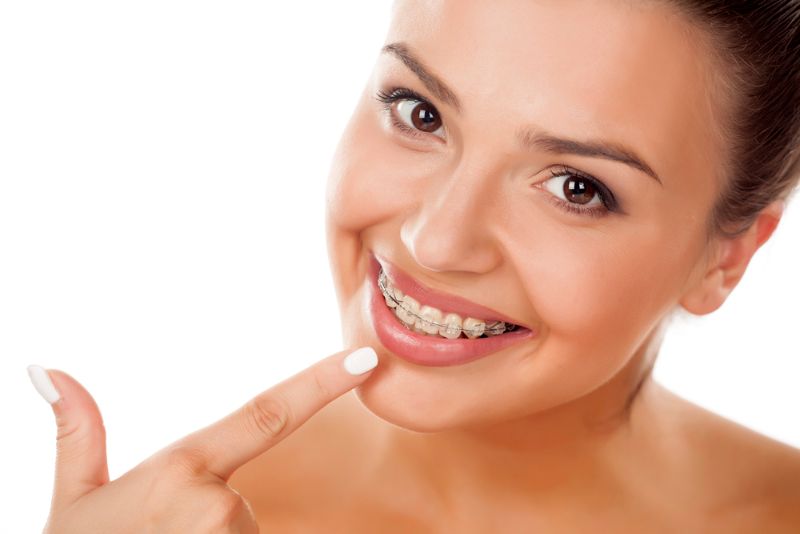 Close-up of a smiling woman proudly highlighting their clear ceramic braces at Tollison Orthodontics in Greenville, SC